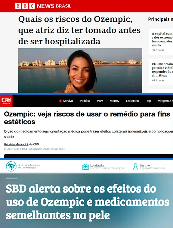 Notícias sobre os riscos do Ozempic e canetas emagrecedoras