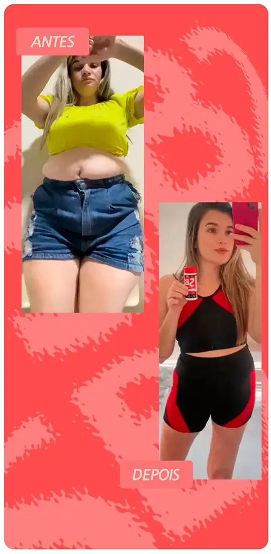 Antes e depois do tratamento com SB2 Turbo